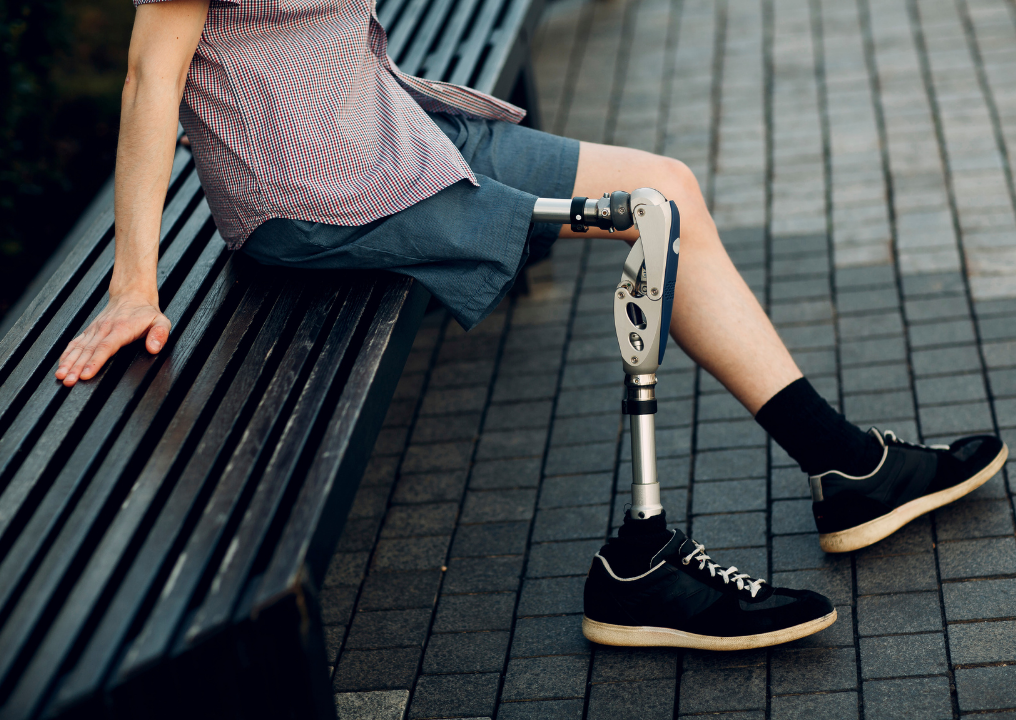 Helping an Osteosarcoma Patient Walk Again with a New Prosthetic Limb